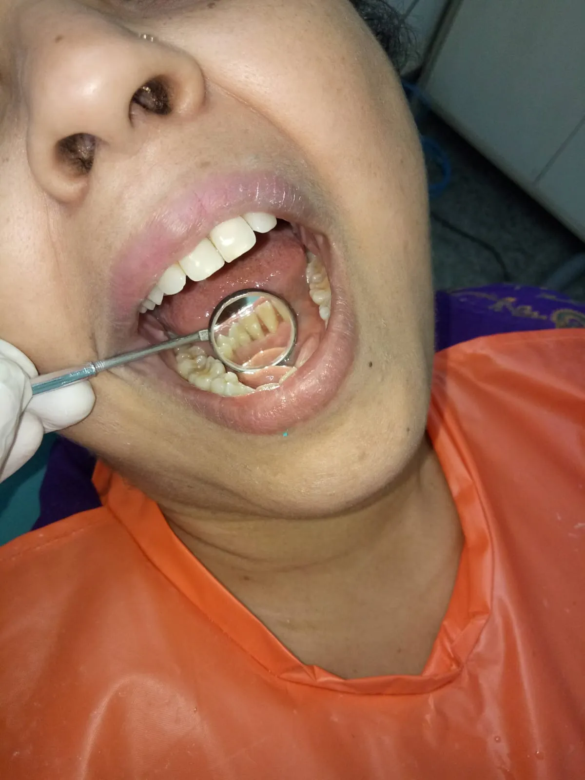 Patient